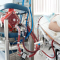 Exploring Success Rates: A Comprehensive Look at Extracorporeal Blood Oxygenation and Ozonation