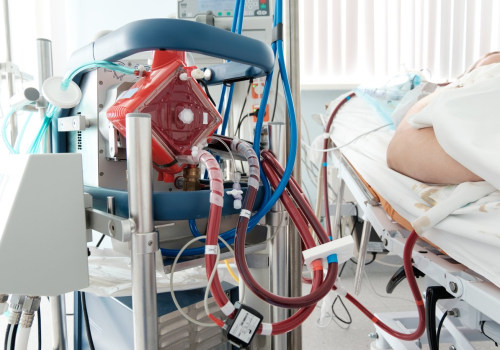 Exploring Success Rates: A Comprehensive Look at Extracorporeal Blood Oxygenation and Ozonation