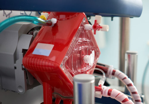 The Benefits of Extracorporeal Blood Oxygenation: A Comprehensive Overview